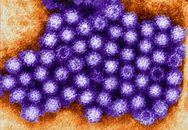 norovirus